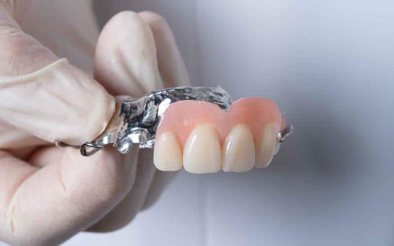 What to Look for When Buying Partial Dentures Online