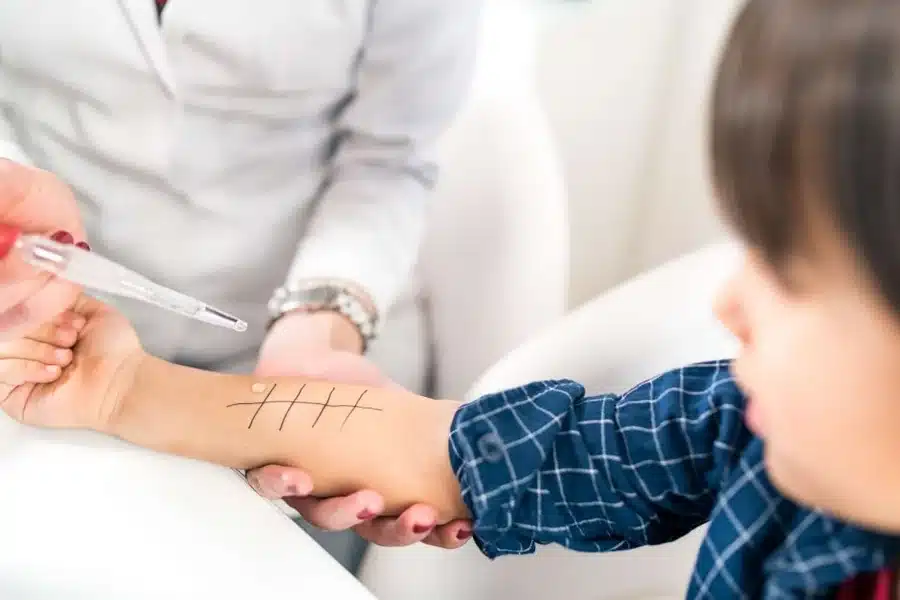 Allergy Testing Singapore