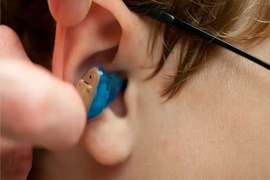Hearing Aids