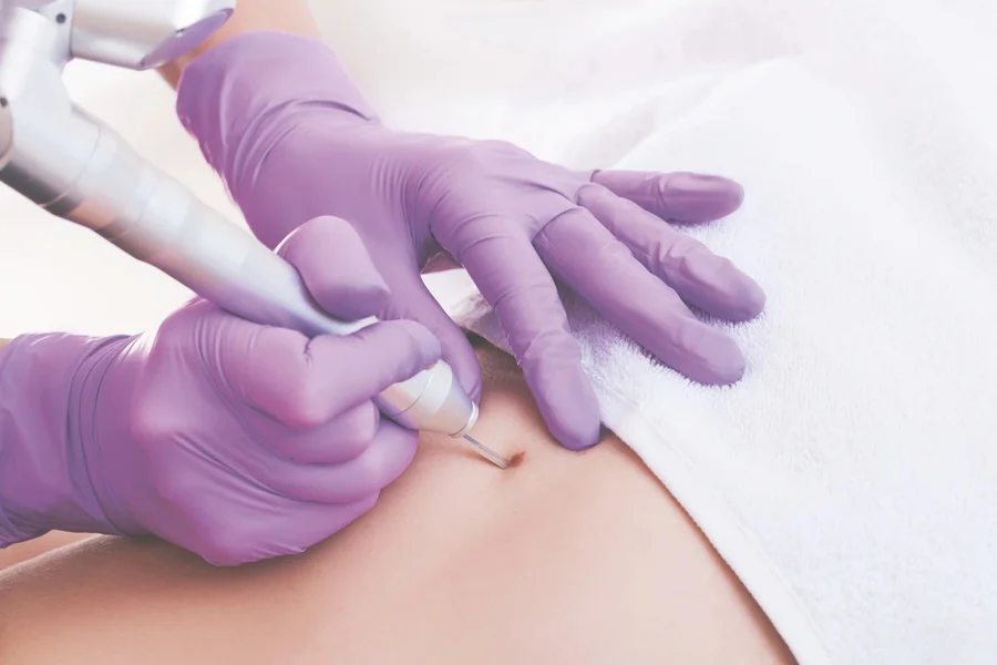 Skin Cancer Surgery Singapore What Is the Expected Recovery Time