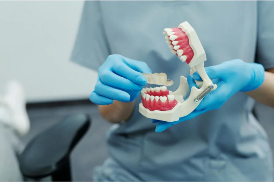 Dental Veneers