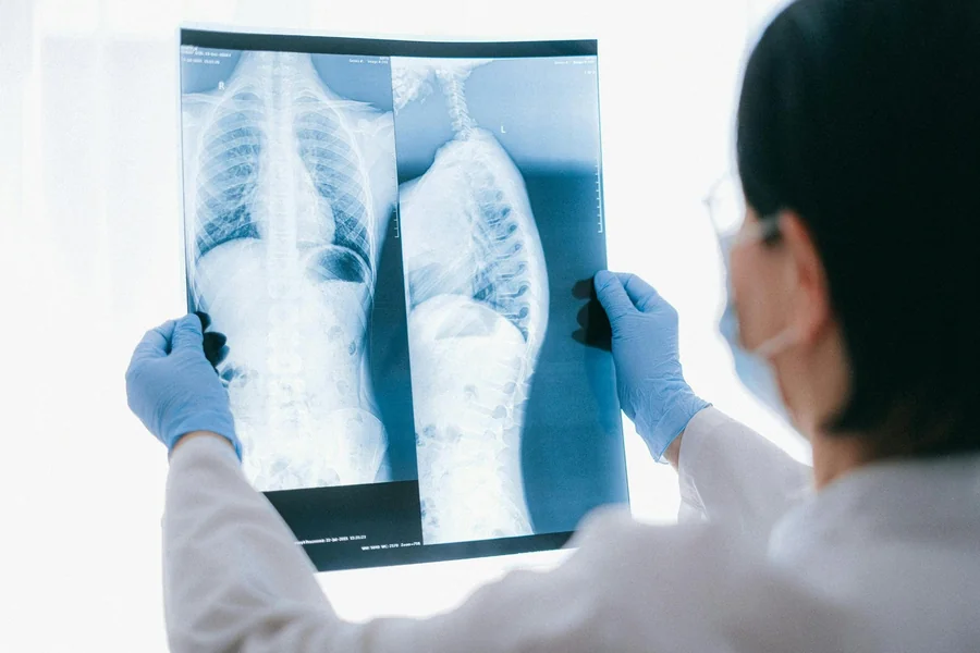 Injury Lawyer