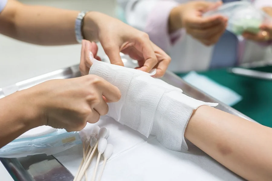 Compensation Available for Burn Injury Victims in Indianapolis