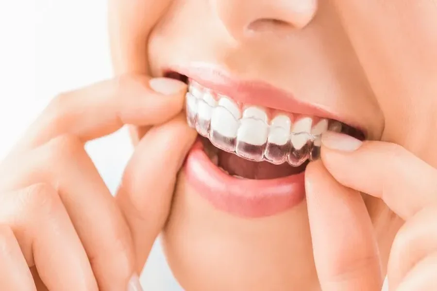 Recommend Retainers