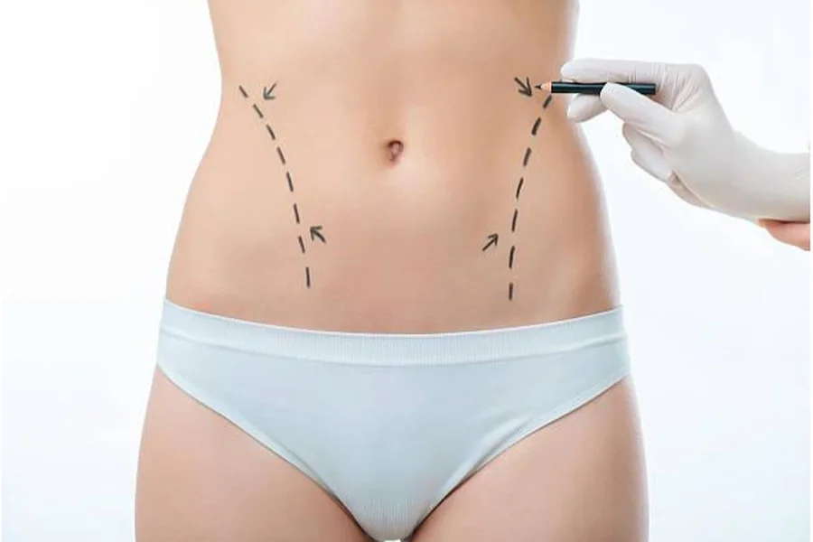 Discover the Benefits of Liposuction at Enfield Royal Clinic Saudi.
