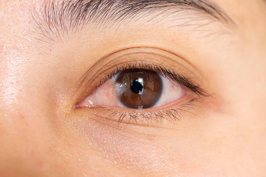 Ophthalmologist Singapore
